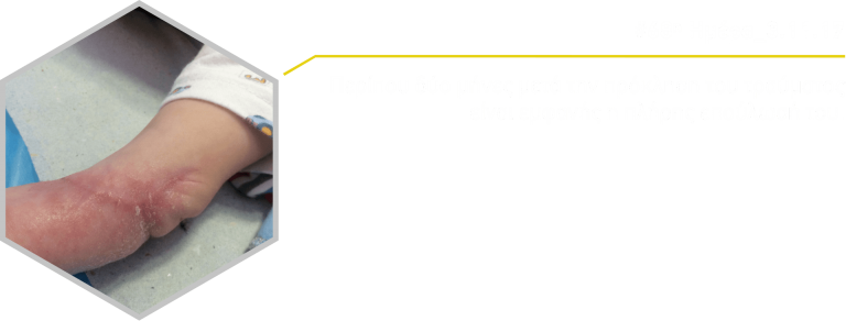 neognologiko-trayma-eksaggeiosis