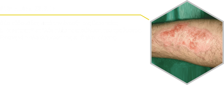 ximiko-egkauma